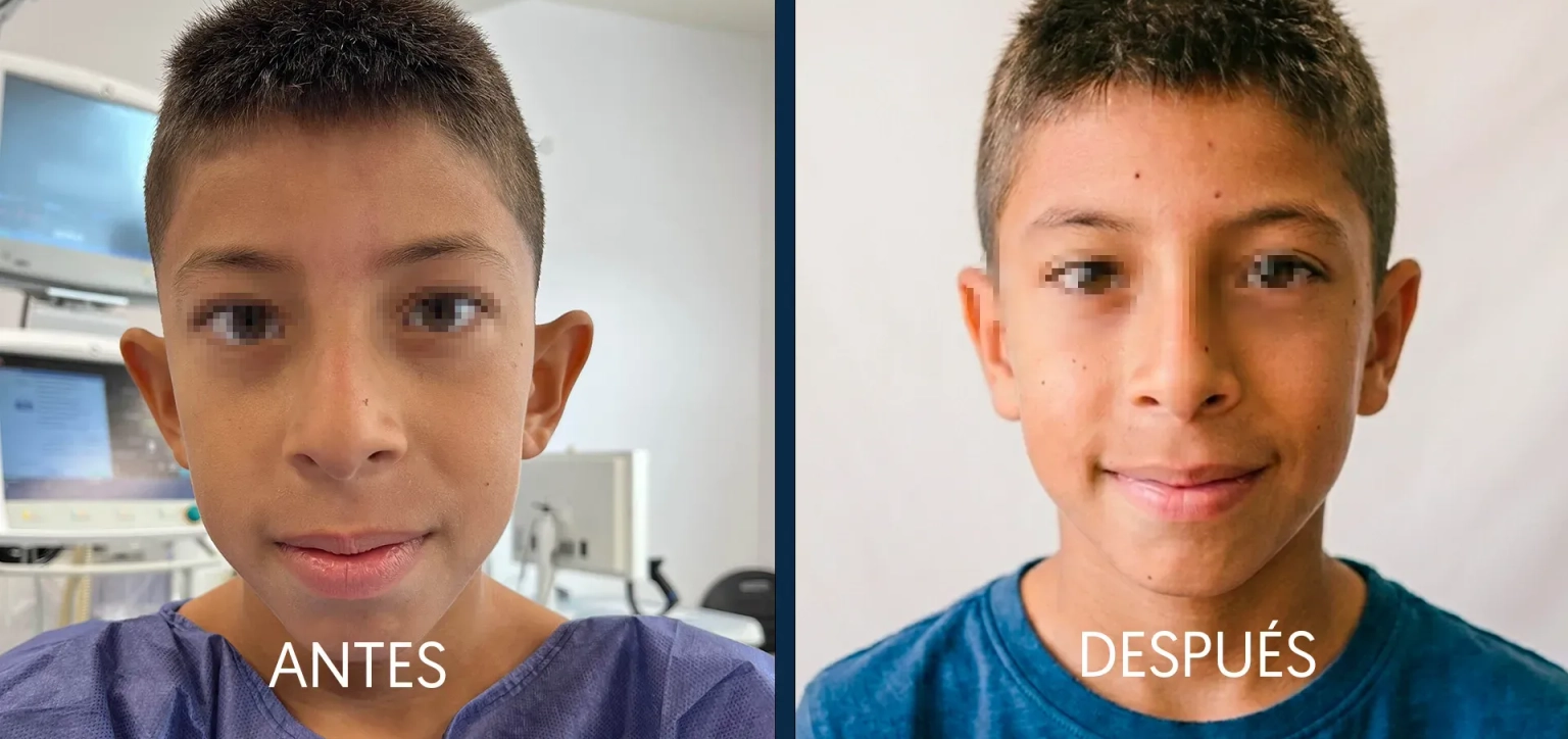 Our surgeon, Santiago Elvira, explains on Antena 3 the aesthetic procedures setting the trend