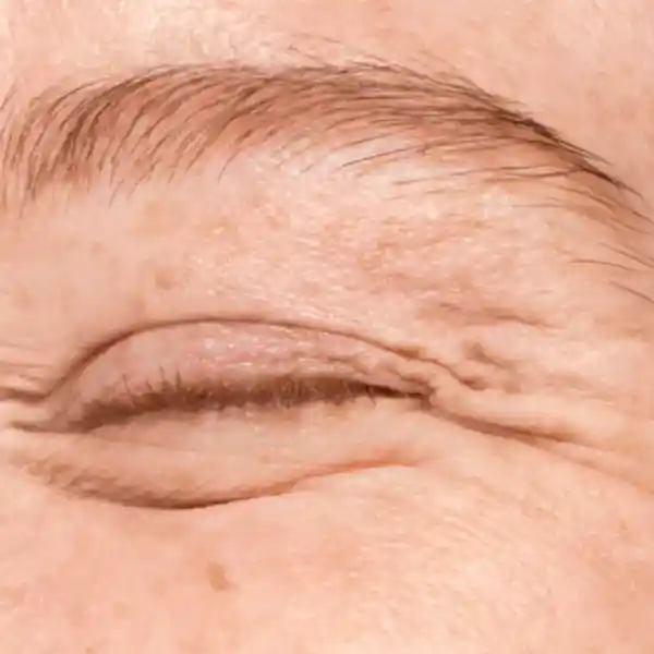 Imagen de EGOS Sabadell Cirugía Plástica