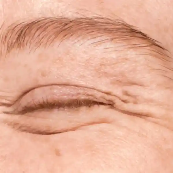 Imagen de EGOS Barcelona Medicina estètica