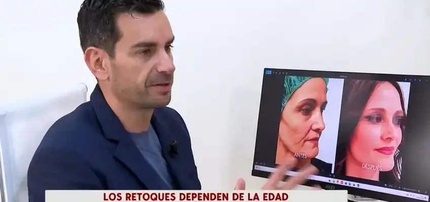 Cirugía estética en adultos: nuestro cirujano, Tiago Gomes, lo explica en Cuatro 