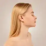 Rinoplastia secundaria de nariz: perfeccione su perfil nasal