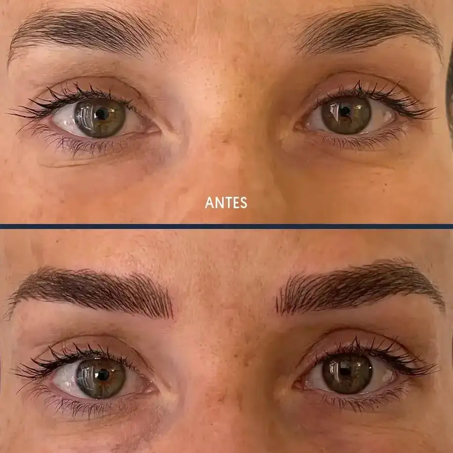 Paciente ideal para microblading técnica pelo a pelo
