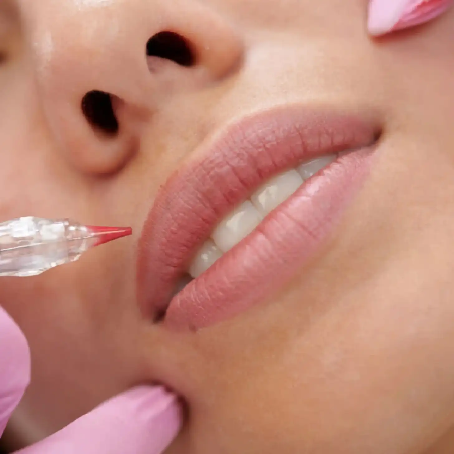 ¿Cómo se realiza el procedimiento?