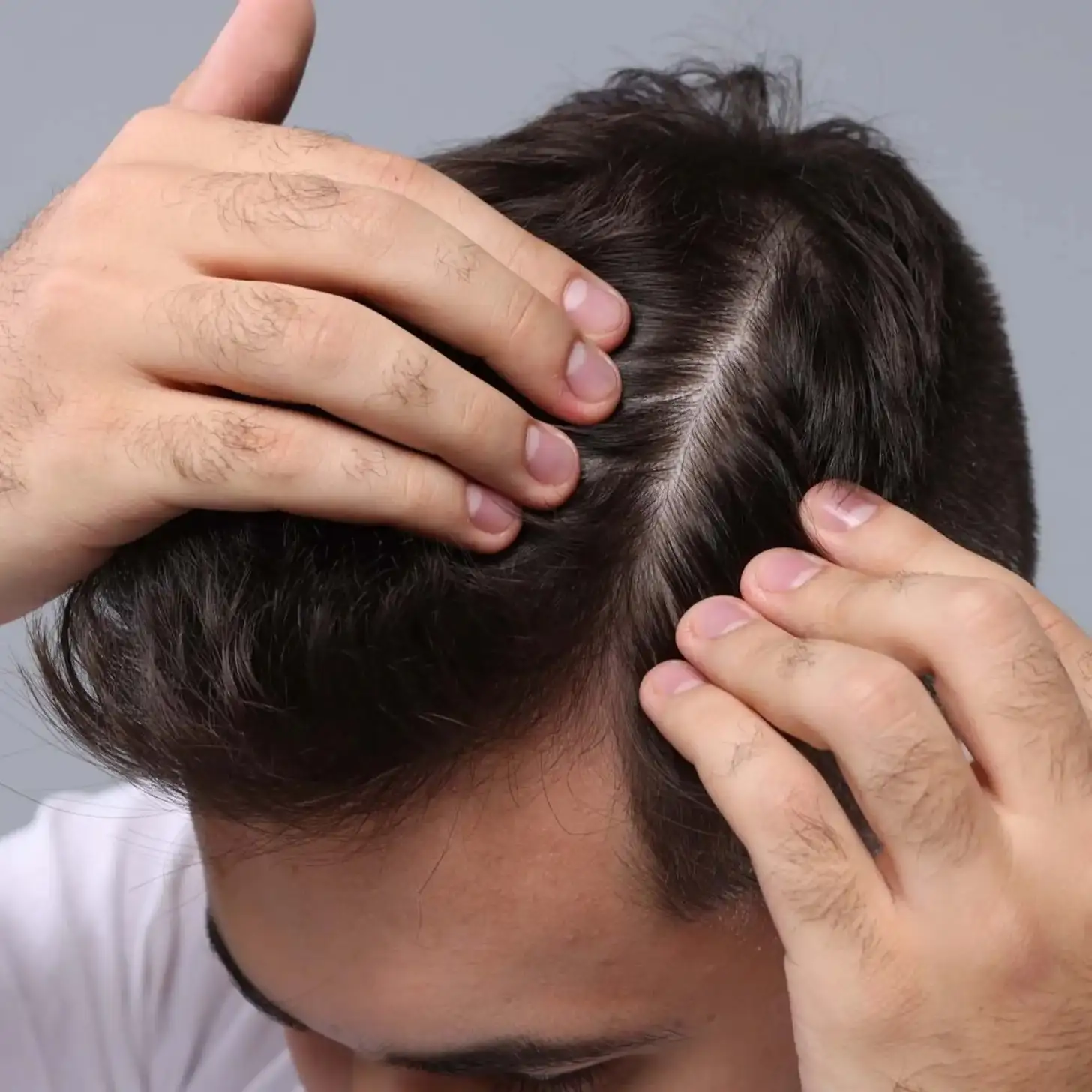 ¿Cómo se realiza el procedimiento?