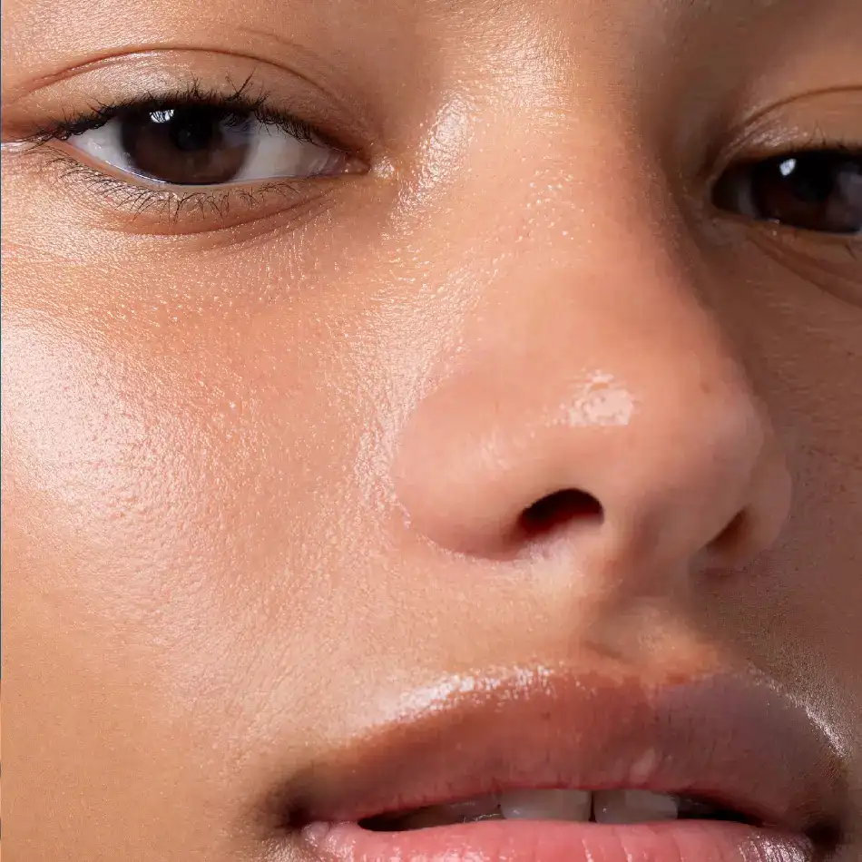 How is the procedure performed?