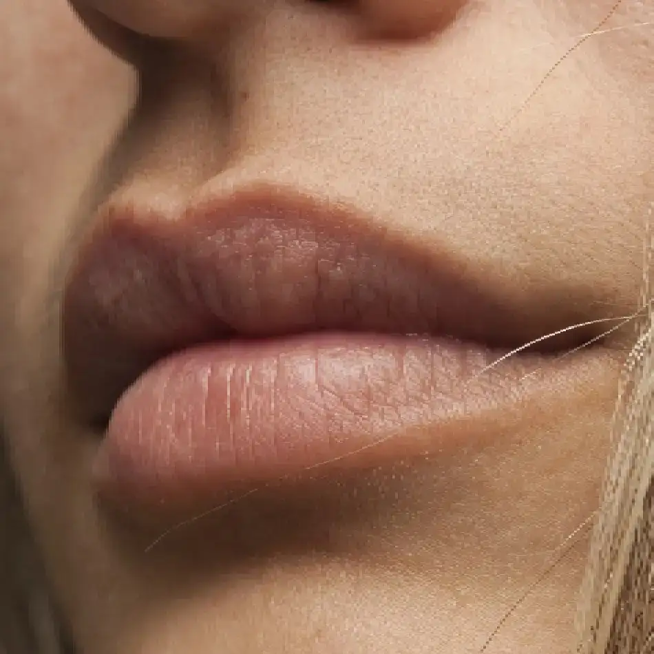 ¿Cuál es el precio de aumento de labios?