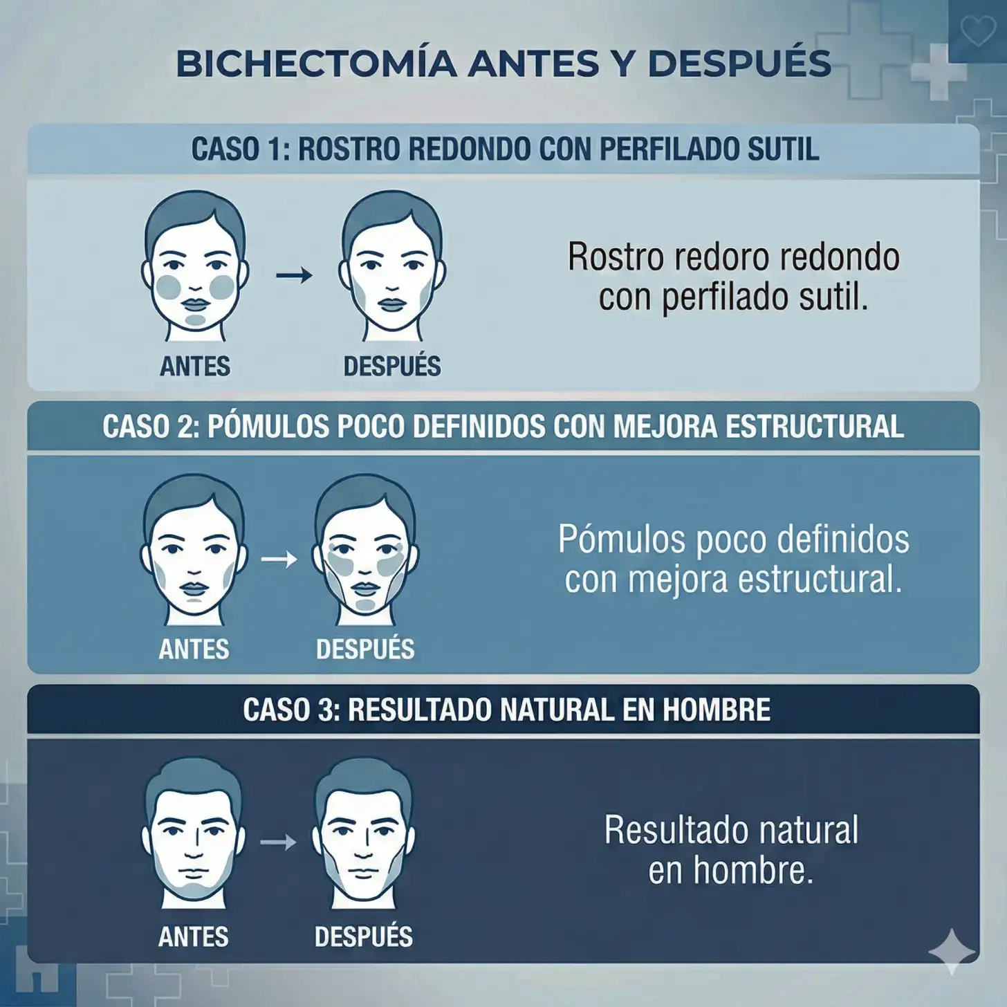 Bichectomía antes y después