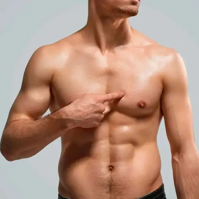 Preguntas frecuentes sobre la cirugía de ginecomastia 