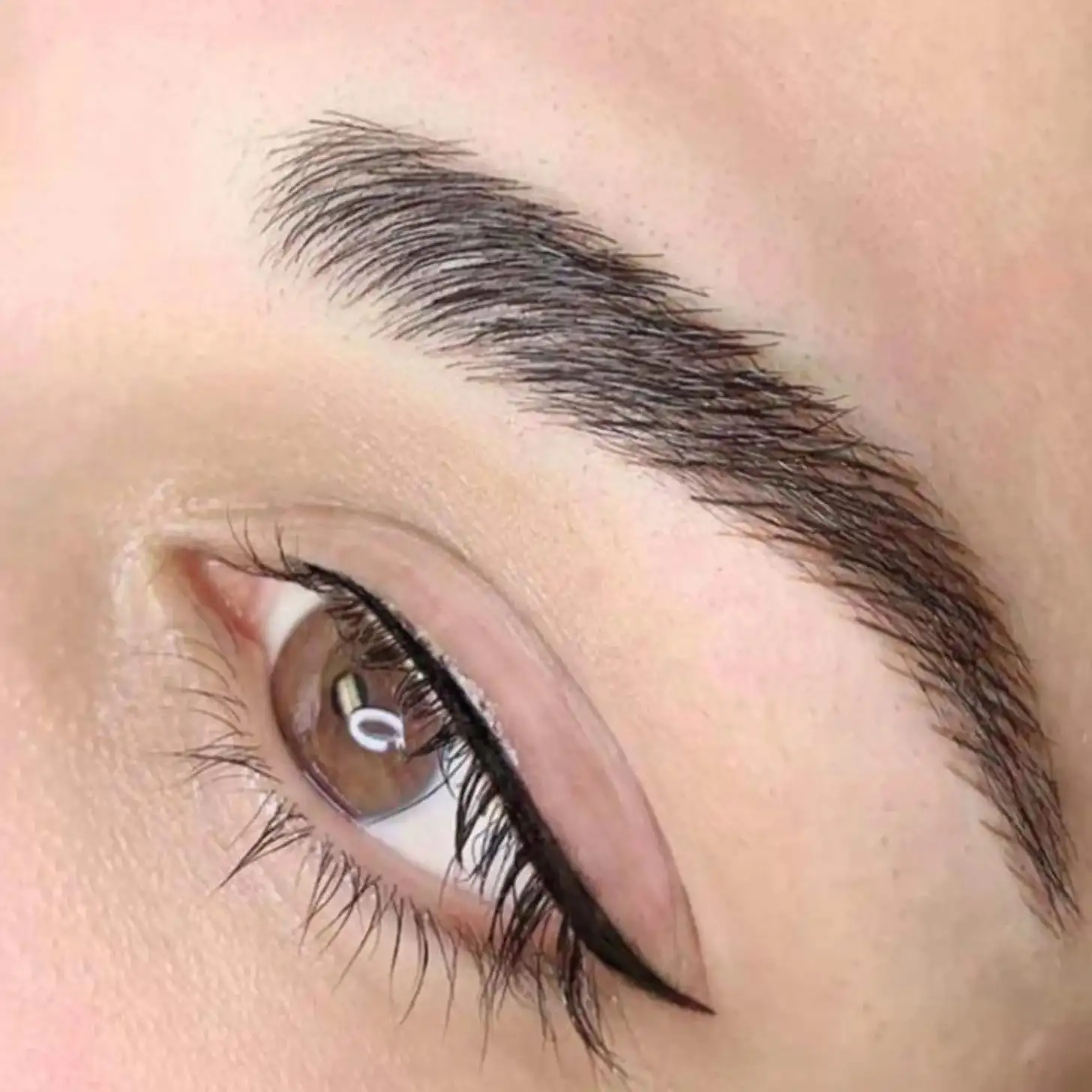 ¿Cómo se realiza el procedimiento?