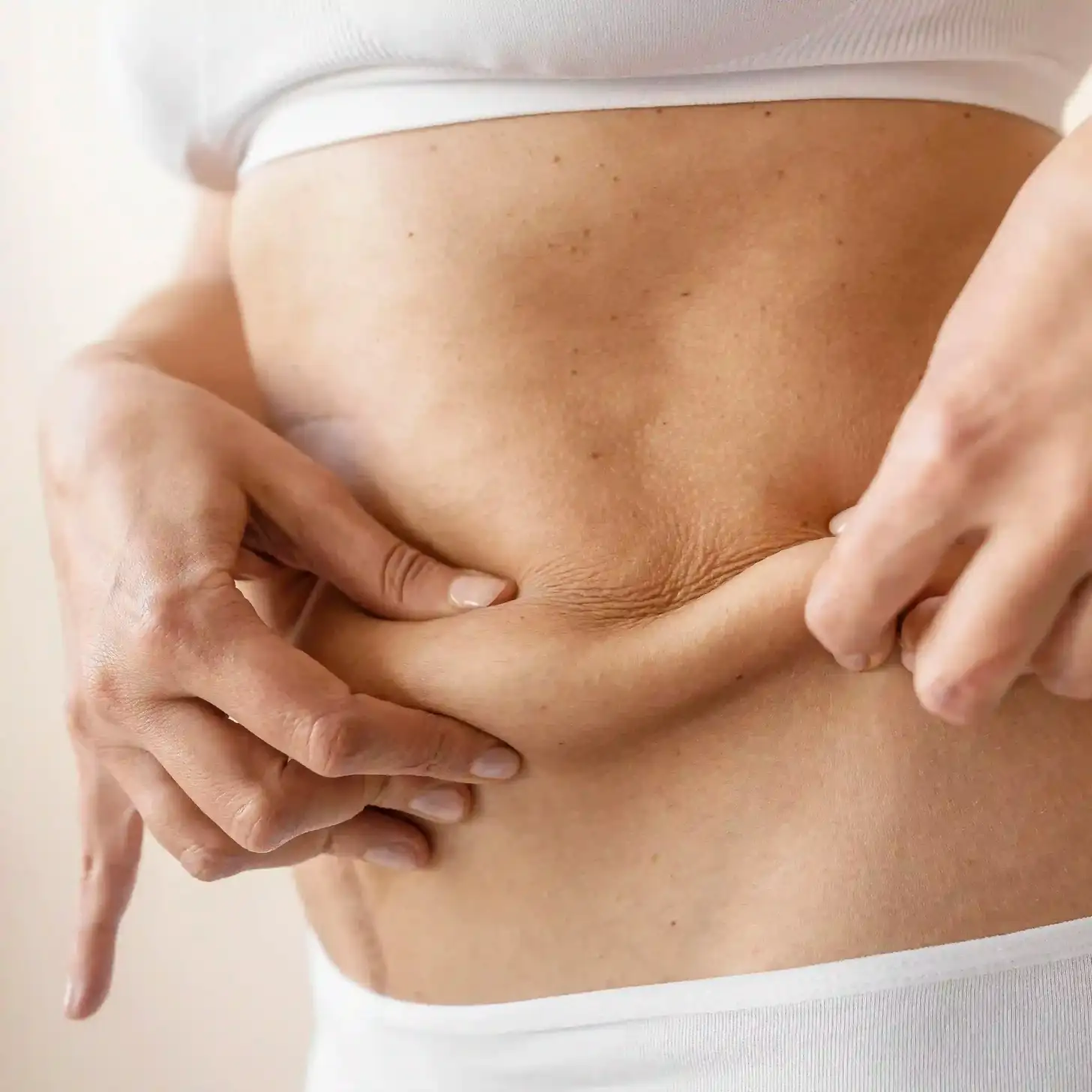 ¿Cómo se realiza el procedimiento de Mesoterapia?