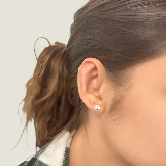 Después de Otoplastia