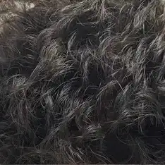 Después de Mesoterapia Capilar