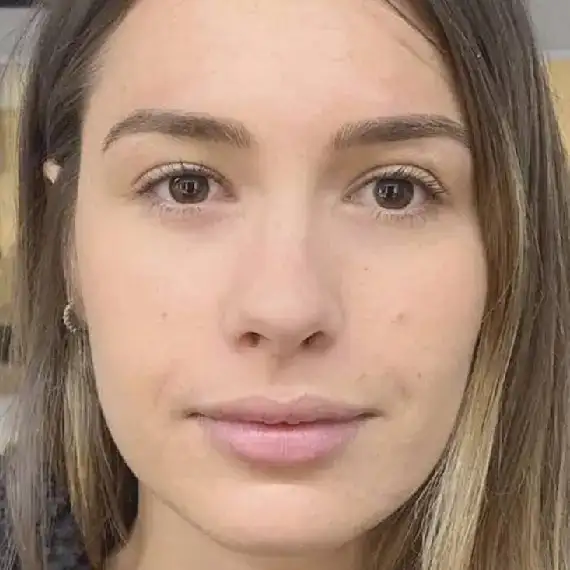 Después de Nanoblanding