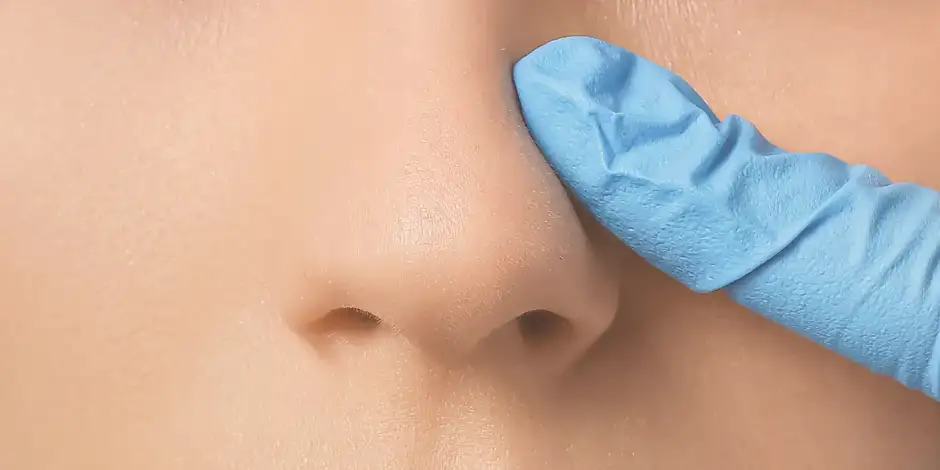 Diferencia entre rinoplastia ultrasónica y rinoplastia tradicional