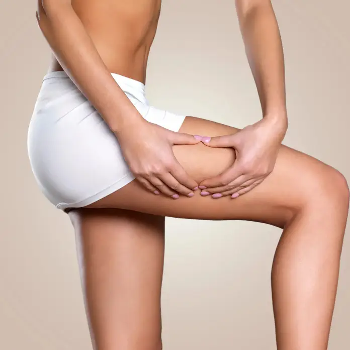 Tratamiento varices sin cirugía: Soluciones efectivas y no invasivas