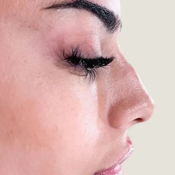 Antes de Rhinomodeling