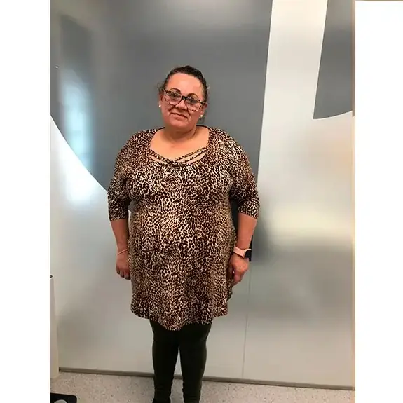 Antes de Va pedre 40kg