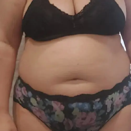 Antes de Liposucción VASER