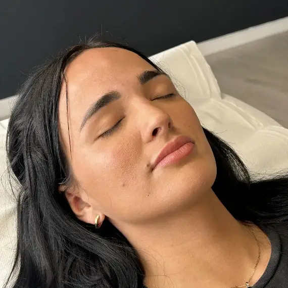 Antes de Relleno de labios