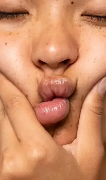 Hidratación de labios en Clínica EGOS