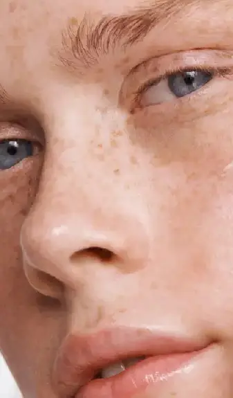 Rhinomodeling surgery.at-clinica