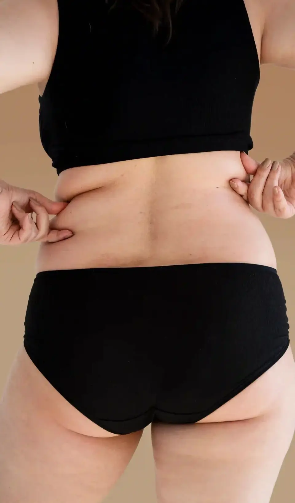 Mesoterapia en Clínica EGOS