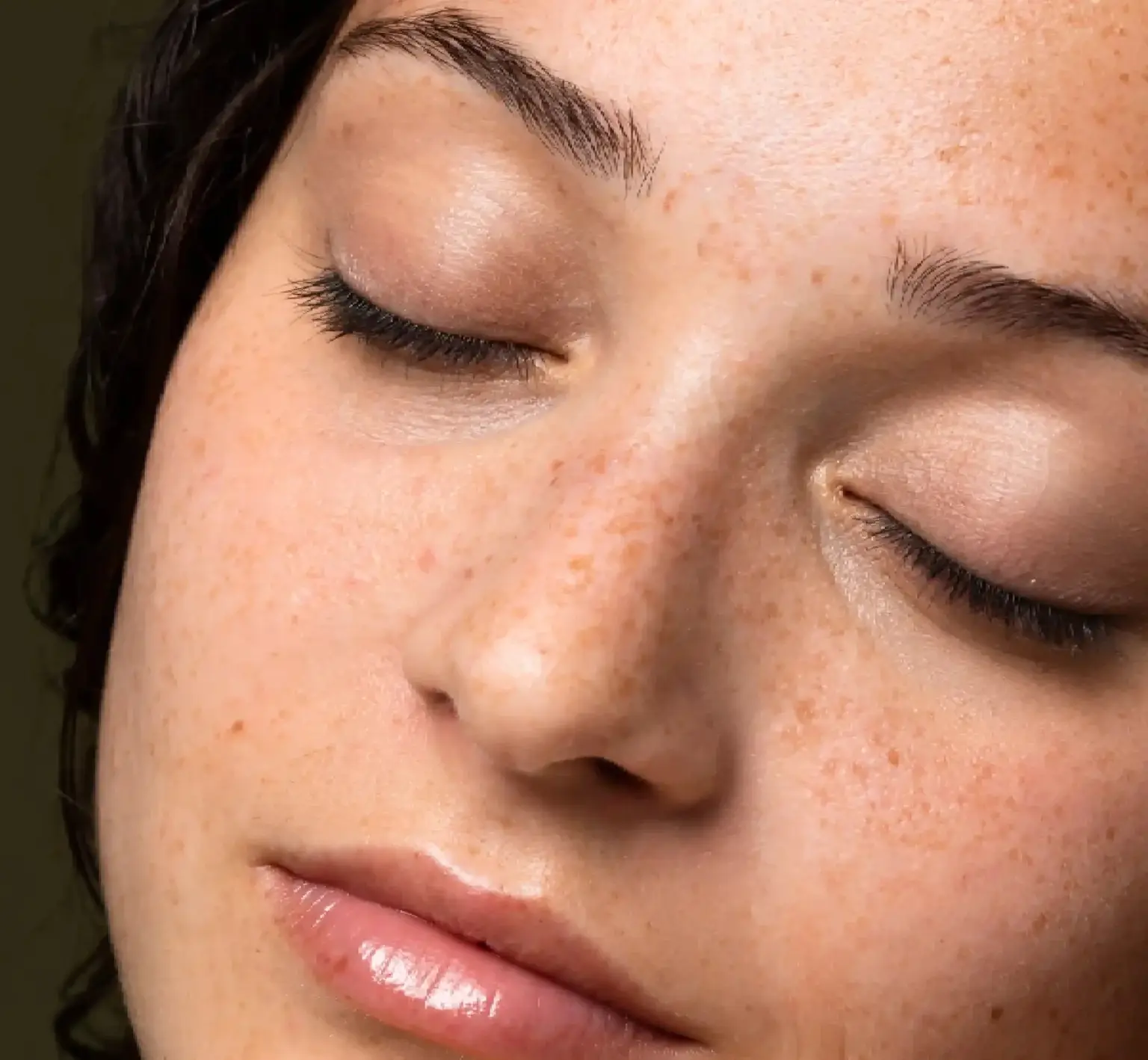 Farciment de ulleres amb àcid hialurònic