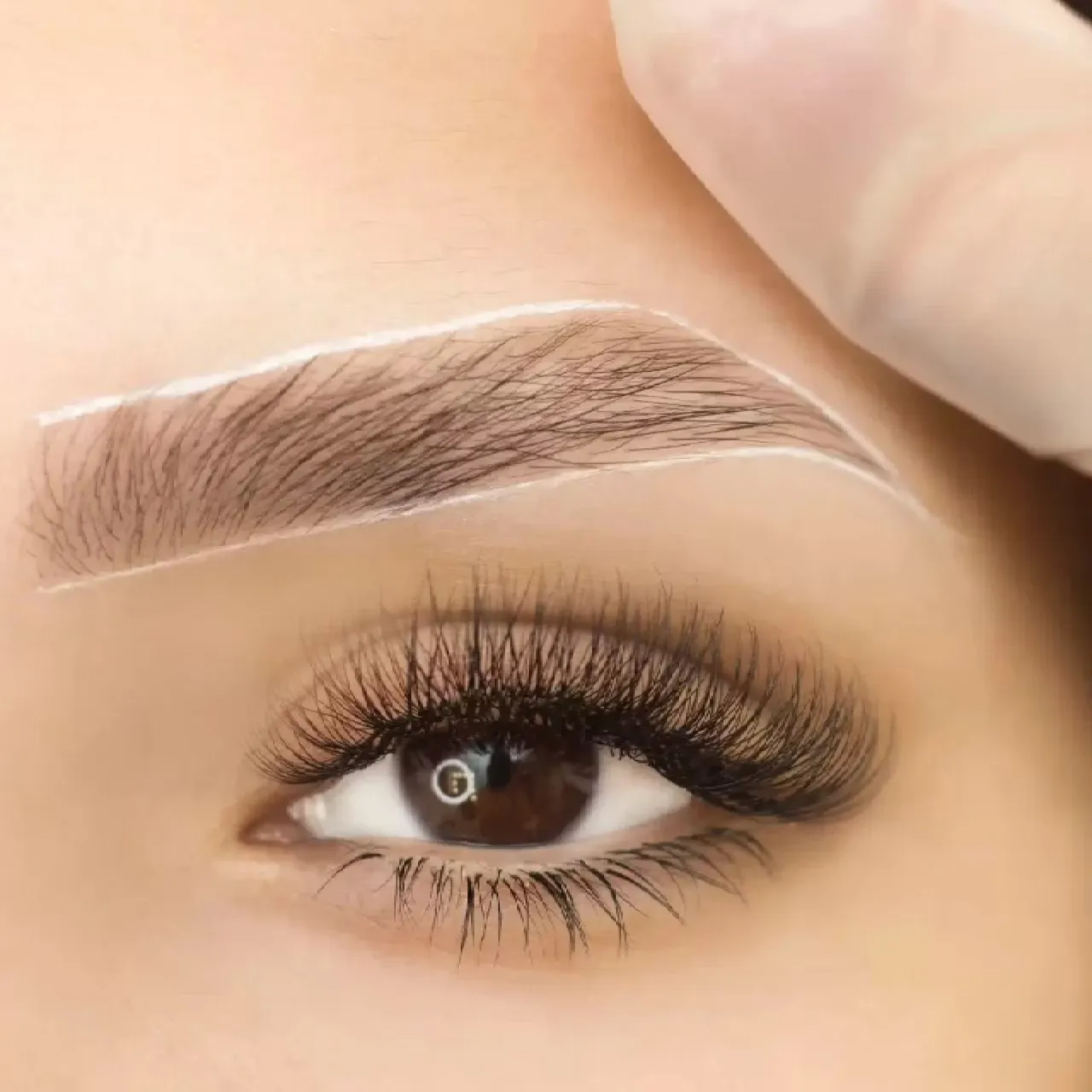 Calcula tu presupuesto de cirugía estética