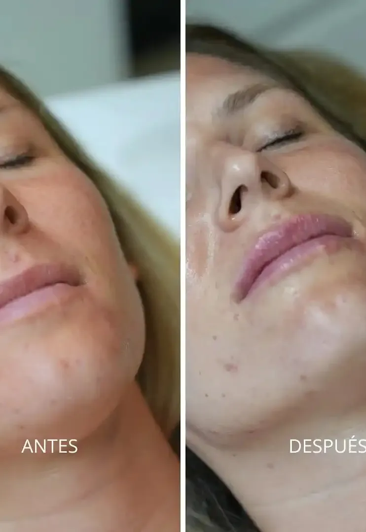 Rocío caso real y su aumento de labios