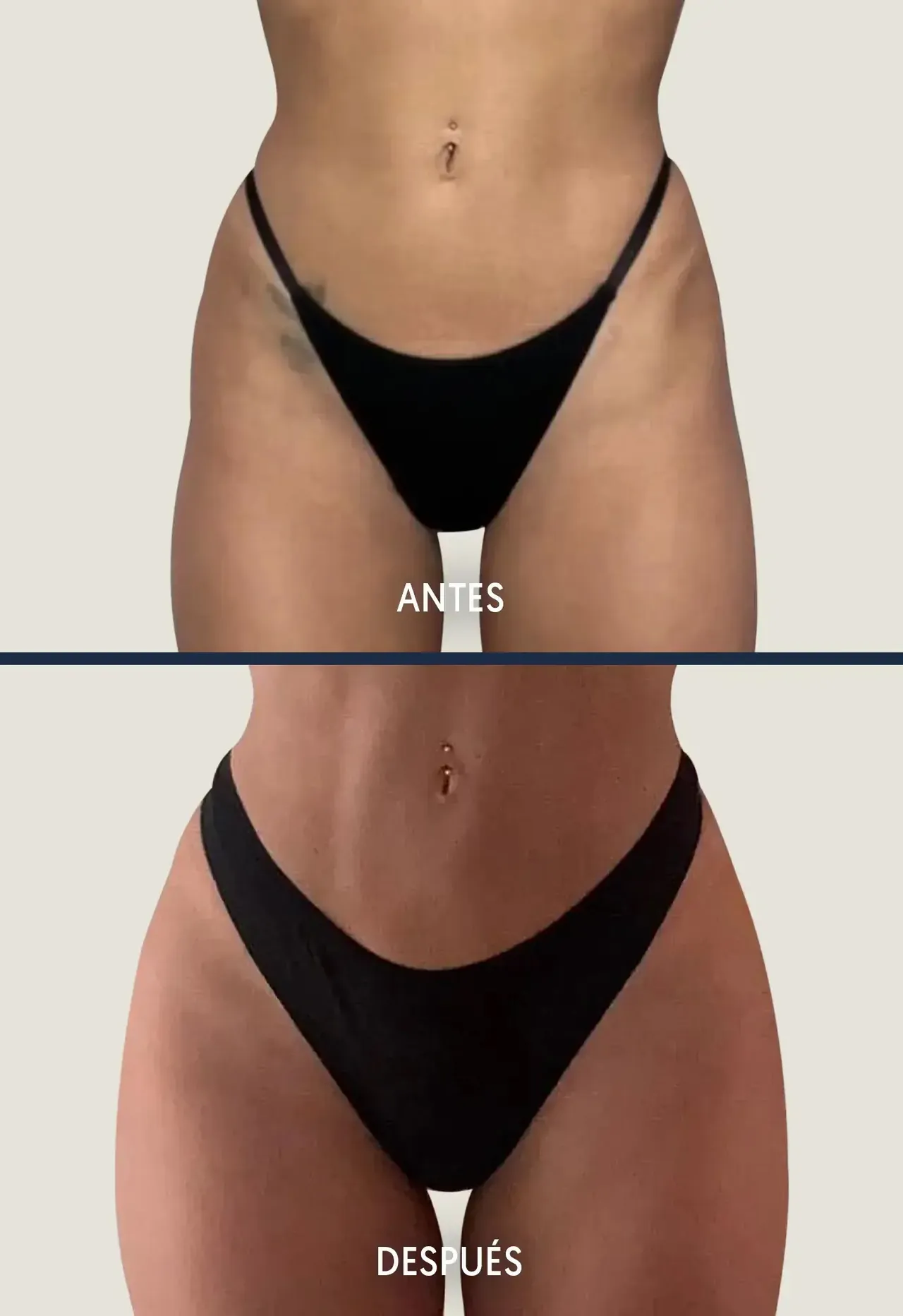 Mónica Bonilla operaciones