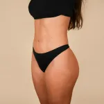 Liposucción VASER: precisión y resultados excepcionales