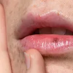 Hidratación de Labios: Consigue unos labios más seductores