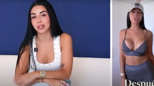 El cambio de Sonia con su amento de pecho