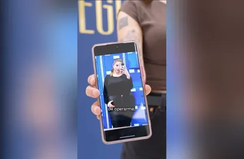 Perder peso. Anaís, De 120 kg a 60 kg con Sleeve Gástrico en Clínica EGOS