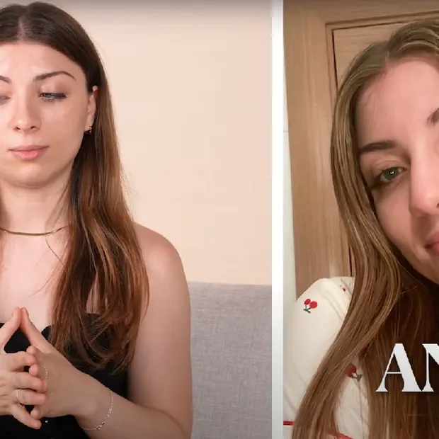 Andrea y rinoplastia ultrasónica 