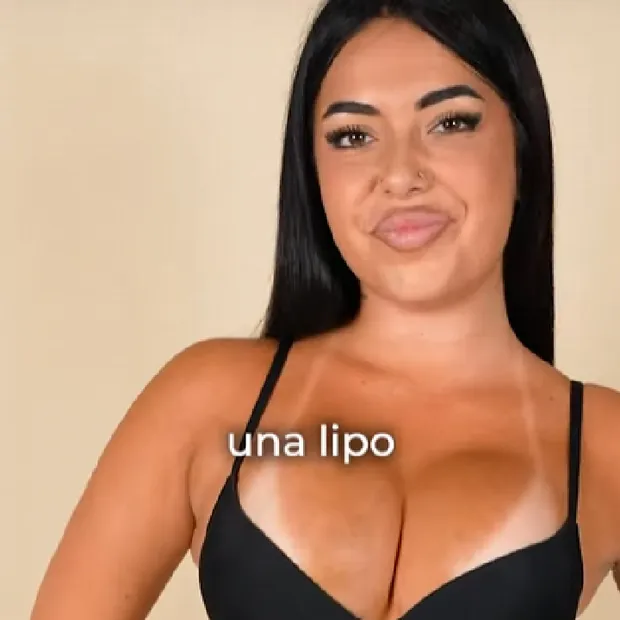 Carla se hace un aumento de glúteos 