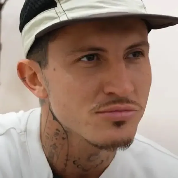 Jonan Wiergo: Mi experiencia con la mesoterapia capilar