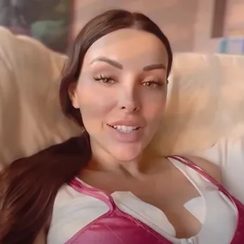 Roser y su transformación