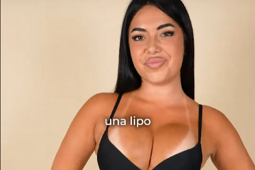 La Carla es fa un augment de glutis