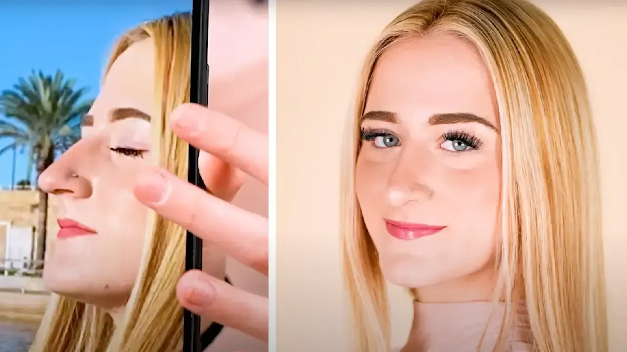 María se hace una rinoplastia