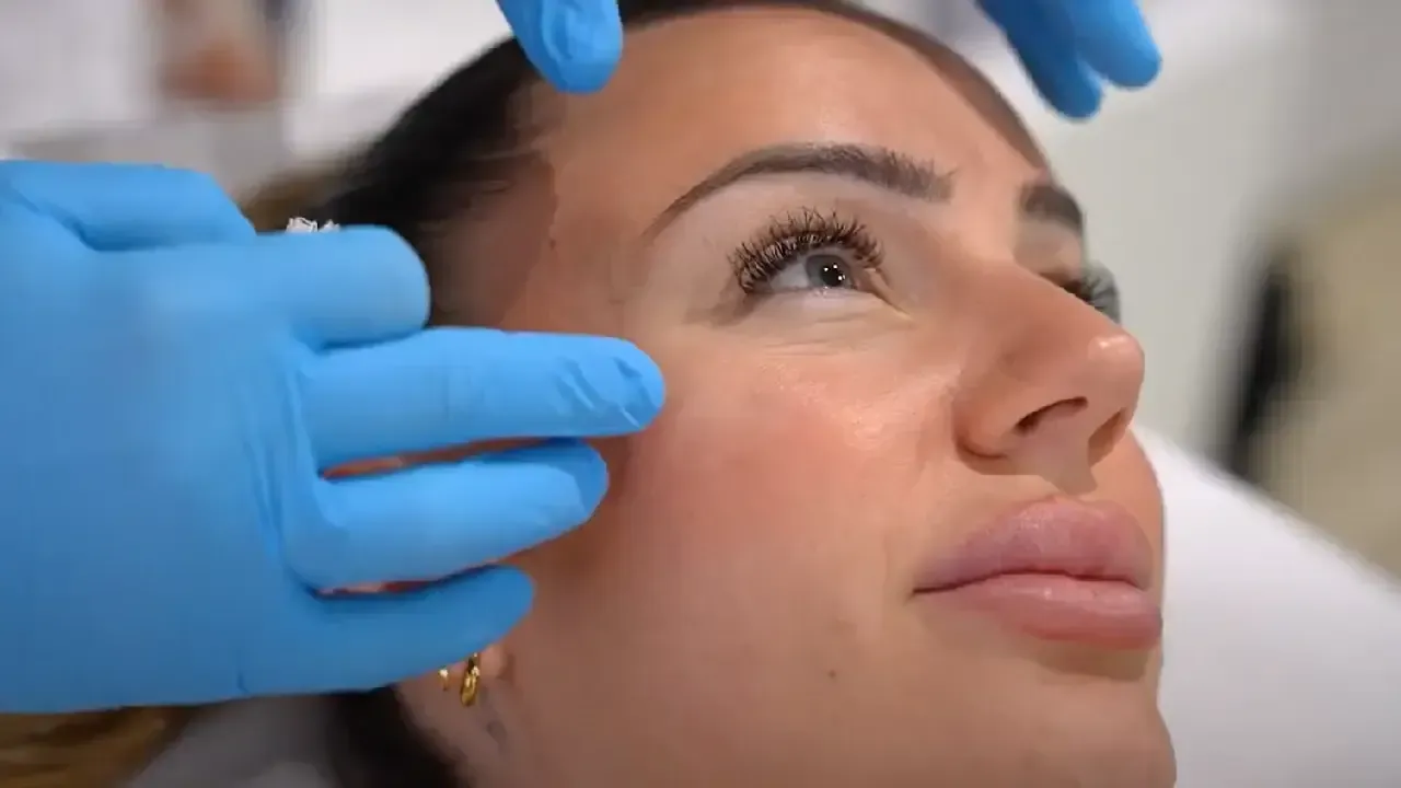 Mariona Corominas tratamiento antiarrugas