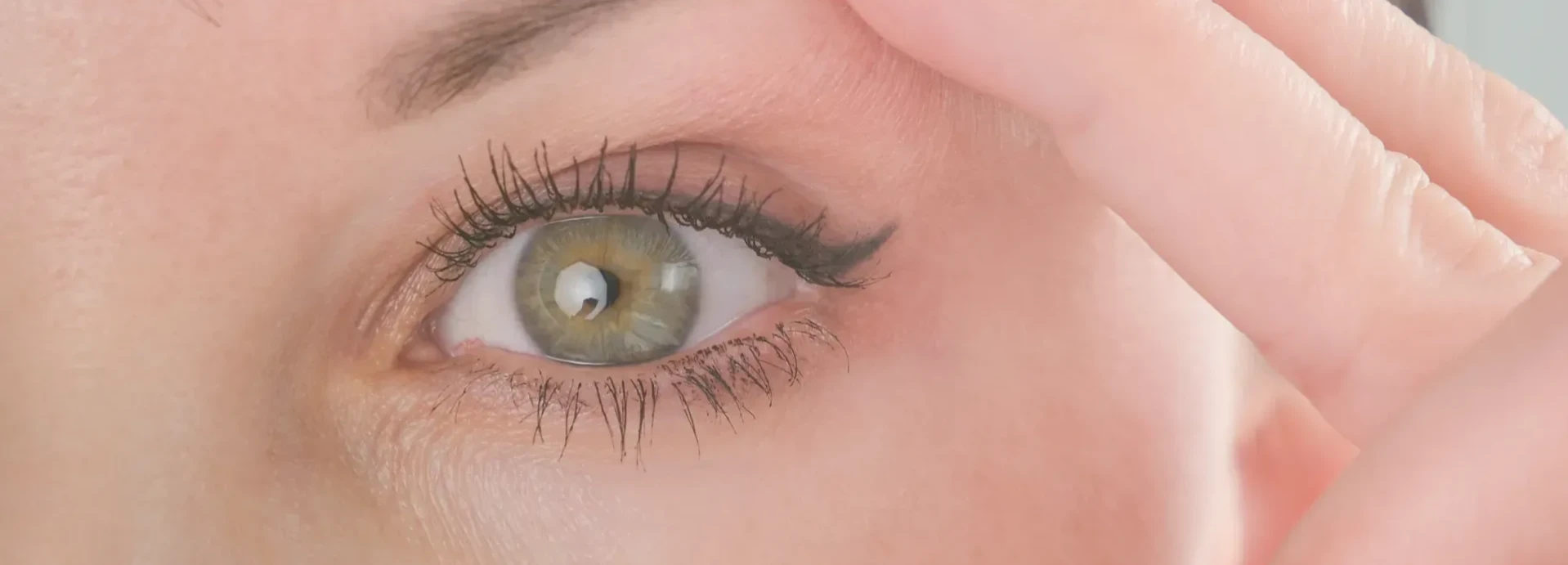 common.image-of ¿Qué es la Blefaroplastia Superior? Todo lo que necesitas saber