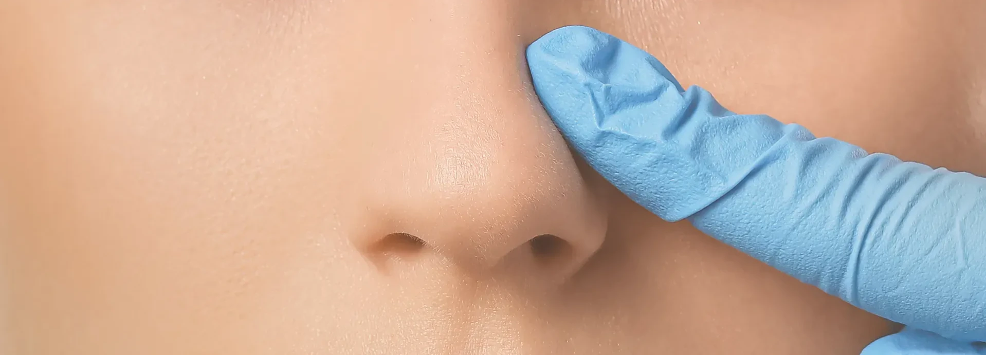 Imagen de Diferencia entre rinoplastia ultrasónica y rinoplastia tradicional