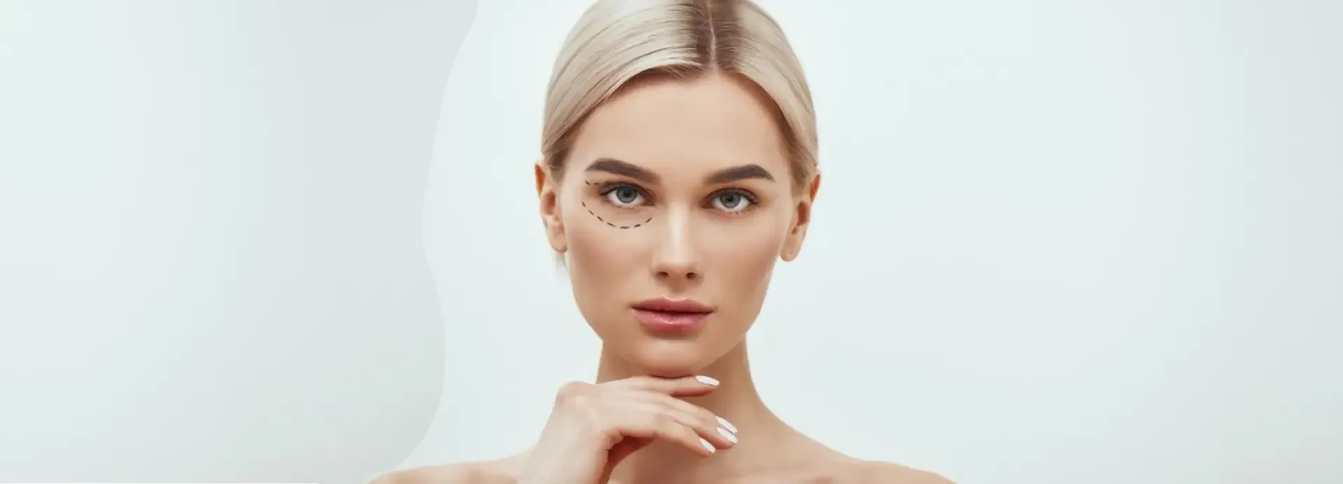 Imagen de ¿Pueden volver a salir las bolsas tras la blefaroplastia?